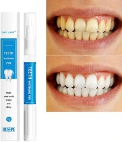 BOR Tanden Bleekpen - Tanden Bleken - Tandenbleekset - Whitening Pen - Tandenblekers - Wittere Tanden - Teeth Whitening Pen - Tanden Bleker -Mondverzorgings Winkel 1031x1200 2