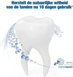 Vitis Whitening Tandpasta 75 Ml -Mondverzorgings Winkel 1141x1200