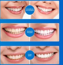 B-care Tanden Bleekpen - Teeth Whitening Pen - Tanden Bleker - Wittere Tanden - Teeth Whitening Strips - Professioneel Resultaat - Tandsteen Verwijderaar - Zonder Peroxide - Tandenbleekset - Tanden Bleken -Mondverzorgings Winkel 1170x1200 5
