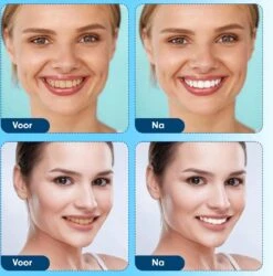 Diamond White - Teeth Whitening Strips - 28x Strips - Zonder Peroxide (0%) - Tandenbleekset - Tandenbleek Strips – Mint -Mondverzorgings Winkel 1185x1200 1