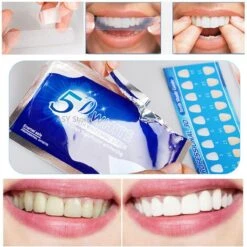 Tanden Bleken Strips | Tanden Bleken | Tanden Strips | Wit Gebit | Witte Tanden | Tandenblekers | Tandenbleekset | Teeth Whitening Strips | Tandenbleek Strips | Geen Crest | Crest Whitestrips | Wittere Tanden | 5D White | 28 Stuks (14zakjes) -Mondverzorgings Winkel 1198x1200 125