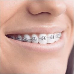 Oral B Oral-B Smartseries Teen - Elektrische Tandenborstel - Wit -Mondverzorgings Winkel 1198x1200 53