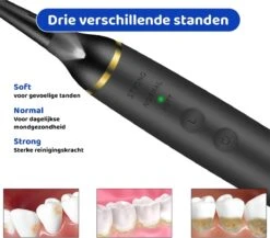 ExCorn Elektrische Tandsteen Verwijderaar - Inclusief 6-delig Tandartsset - 3 Standen - Elektrisch Tandplak Verwijderen - Tanden Polijsten -Mondverzorgings Winkel 1200x1055