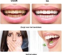 BOR Tanden Bleekpen - Tanden Bleken - Tandenbleekset - Whitening Pen - Tandenblekers - Wittere Tanden - Teeth Whitening Pen - Tanden Bleker -Mondverzorgings Winkel 1200x1061 2