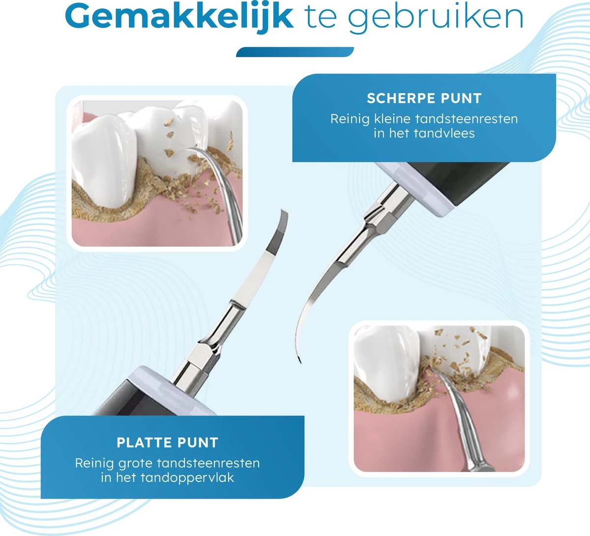 V-Goods Premium Sonische Tandsteen Verwijderaar - 5 Standen - Inclusief Tandarts Set - 3 Opzetstukken - Tandplak 6 V-Goods Premium Sonische Tandsteen Verwijderaar - 5 Standen - Inclusief Tandarts Set - 3 Opzetstukken - Tandplak - Afbeelding 4