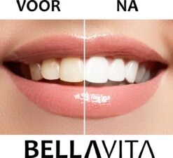 BELLAVITA Tandenbleekset - Tanden Bleken - Teeth Whitening Kit - Tandenblekers - 4 Gelpennen - Zonder Peroxide - 100% Natuurlijk - Witte Tanden -Mondverzorgings Winkel 1200x1095 2