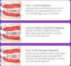 Edoir Rechte Tanden Beugel - Retainer Voor Rechte Tanden - Rechte Tanden Bitje -Mondverzorgings Winkel 1200x1109 1