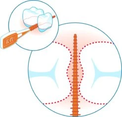 Tepe EasyPick Paars Maat XL – 36 Stuks -Mondverzorgings Winkel 1200x1146 1