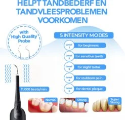 Merkloos Tandsteen Verwijderaar - 5 Standen - Inclusief Tandarts Set - Met 3 Opzetstukken - Elektrisch - Tandplak -Mondverzorgings Winkel 1200x1153 3