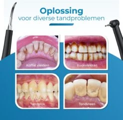 Professionele Tandsteen Verwijderaar - 5 Standen - Inclusief Tandarts Set - Met 3 Opzetstukken - Elektrisch - Tandplak -Mondverzorgings Winkel 1200x1169 4