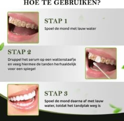 Teeth Whitening Serum Met 10 Wattenstaafjes - Tandenbleker - Teeth Whitening Strips - Tanden Witten - Tandenblekers - Witte Tanden - 10ml - Valentijnsdag Cadeau -Mondverzorgings Winkel 1200x1170 2