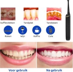 ExCorn Elektrische Tandsteen Verwijderaar - Inclusief 6-delig Tandartsset - 3 Standen - Elektrisch Tandplak Verwijderen - Tanden Polijsten -Mondverzorgings Winkel 1200x1173 2