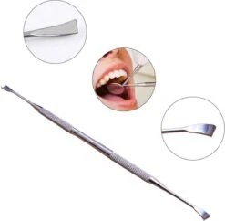 Merkloos Zelf Tandsteen En Plak Verwijderen Met Deze Tandsteen Schraper