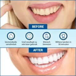 V-Goods Premium Whitening Strips - Tandenbleek Strips - Wittere Tanden - 28x Tandenbleek Strips DIRECT Resultaat - Tandenbleekset - Whitening - Tandenblekers -Mondverzorgings Winkel 1200x1199 14