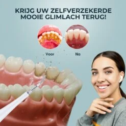 Merkloos Tandsteen Verwijderaar Elektrisch – Tandenborstel Opzetstukken - Tandarts Spiegel - 5 Standen -Wit -Mondverzorgings Winkel 1200x1200 1013