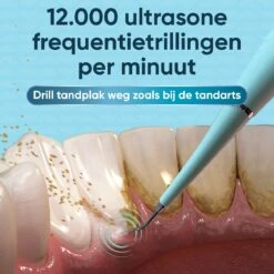 Whitee Elektrische Tandsteen Verwijderaar - Tanden Polijsten - Tandarts Tandsteenverwijderaars - Elektrisch Tandplak Verwijderen -Mondverzorgings Winkel 1200x1200 1032