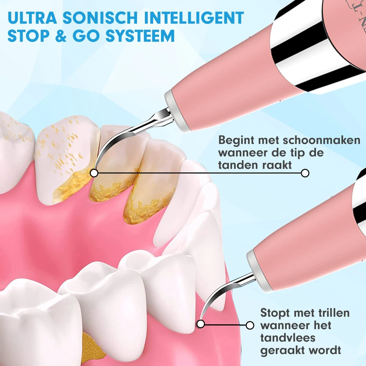 DEN-T® PRO U500 - Elektrische Sonische Tandsteen Verwijderaar - Roze 12 DEN-T® PRO U500 - Elektrische Sonische Tandsteen Verwijderaar - Roze - Afbeelding 10