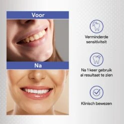 Merkloos Tanden Bleken Met 14 Sets Whitening Strips - Tandenbleekset Met Bamboe Tandenborstel - Tanden Bleekstrips -Mondverzorgings Winkel 1200x1200 1068