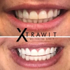 Xtrawit - Teeth Whitening Strips - Tandenbleekset - Wittere Tanden - Goedgekeurde Tandenbleek Strips - 30 Strips -Mondverzorgings Winkel 1200x1200 1078