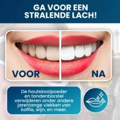 Tandenbleekset - Teeth Whitening - Teeth Whitener - Wittere Tanden - Tanden Bleken - Direct Resultaat - Zelfde Effect Als Whitening Strips 12 Tandenbleekset - Teeth Whitening - Teeth Whitener - Wittere Tanden - Tanden Bleken - Direct Resultaat - Zelfde Effect Als Whitening Strips -Mondverzorgings Winkel 1200x1200 1088