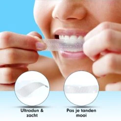 Diamond White - Teeth Whitening Strips - 28x Strips - Zonder Peroxide (0%) - Tandenbleekset - Tandenbleek Strips – Mint -Mondverzorgings Winkel 1200x1200 1121