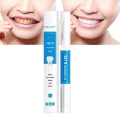 BOR Tanden Bleekpen - Tanden Bleken - Tandenbleekset - Whitening Pen - Tandenblekers - Wittere Tanden - Teeth Whitening Pen - Tanden Bleker -Mondverzorgings Winkel 1200x1200 1139