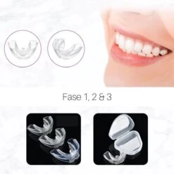 Edoir Rechte Tanden Beugel - Retainer Voor Rechte Tanden - Rechte Tanden Bitje -Mondverzorgings Winkel 1200x1200 1147