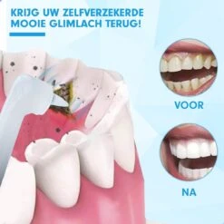 DEN-T® PRO P350 Elektrische Tandenpolijster - Wit - 5 Standen - 5 Opzetstukken - Polijstmachine - Polijstset - Tanden Polijsten - -Mondverzorgings Winkel 1200x1200 734