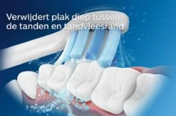 Philips Sonicare DiamondClean 9000 HX9911/29 - Luxe Elektrische Tandenborstel - Lichtroze -Mondverzorgings Winkel 1200x799 2