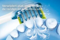 Philips Sonicare DiamondClean 9000 HX9911/29 - Luxe Elektrische Tandenborstel - Lichtroze -Mondverzorgings Winkel 1200x799 5