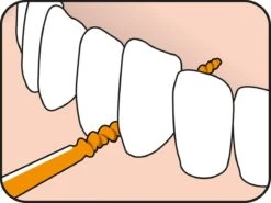 Tepe EasyPick Oranje Maat XS/S – 36 Stuks -Mondverzorgings Winkel 1200x897 1