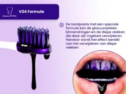 Glory Of White V34 Serum - Kleurcorrector - Witte Tanden - Tandpasta - Tanden Reinigen - Teeth Whitening - 30ML -Mondverzorgings Winkel 1200x899 2