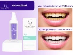 Glory Of White V34 Serum - Kleurcorrector - Witte Tanden - Tandpasta - Tanden Reinigen - Teeth Whitening - 30ML -Mondverzorgings Winkel 1200x899 5