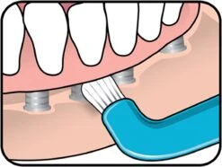 TePe Compact Tuft - Single Tufted Borstel - Tandenborstel -Mondverzorgings Winkel 1200x902 1