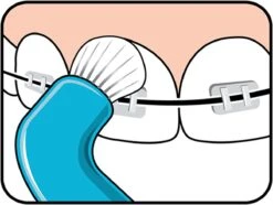 TePe Compact Tuft - Single Tufted Borstel - Tandenborstel -Mondverzorgings Winkel 1200x902