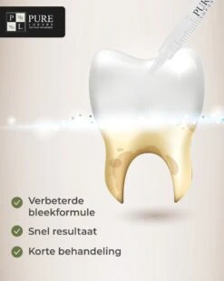 3x Navulling Tanden Bleekgel Spuiten ZONDER Peroxide - Refill Gel - Navulling - Veilig Tanden Bleken - Witte Tanden - Teeth Whitening - Valentijnsdag Cadeau -Mondverzorgings Winkel 960x1200 17