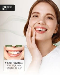 Tandenbleekset INCL. 14 Whitening Strips En 6 Gelpennen - ZONDER PEROXIDE - Teeth Whitening Kit - Tandenbleekset Met Ebook En Nederlandse Handleiding - Tandenblekers - Valentijnsdag Cadeau -Mondverzorgings Winkel 960x1200 7